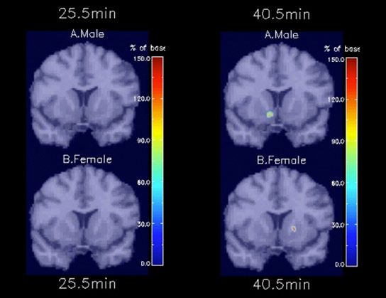 大腦對吸煙的反應是不同的男女