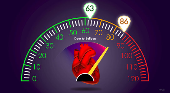 研究表明，減少D2B時間有一種醫(yī)療益處