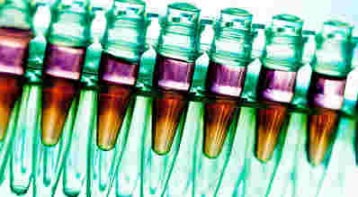 耶魯開發(fā)了一種更快，更便宜的方式來分析基因活動